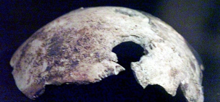 25. 7. 2009 Skull attributed to Hitler belonged to a woman